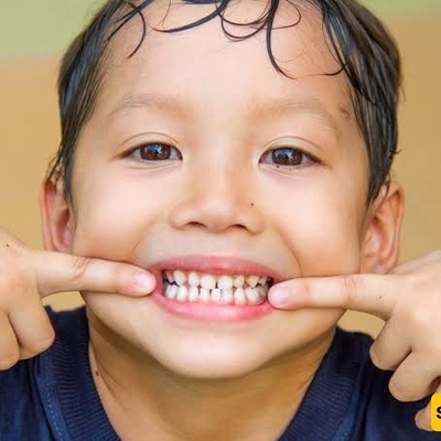 Foods That Support Healthy Teeth in Children