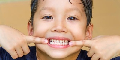 Foods That Support Healthy Teeth in Children