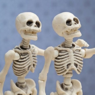 A 20-Year-Old Girl with a Rare Condition Who Has No Bones in Her Body! + Astonishing Photos