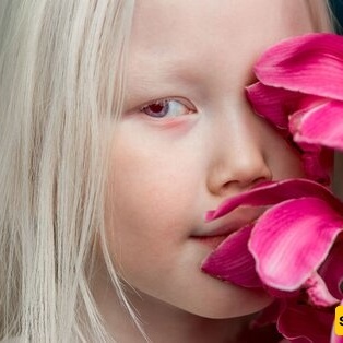 Meet the Incredible Baby Girl with Ever-Changing Eyes, Known as the 'Snow-White Child of Zal'—A Stunningly Unique Beauty 😍