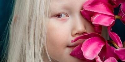 Meet the Incredible Baby Girl with Ever-Changing Eyes, Known as the 'Snow-White Child of Zal'—A Stunningly Unique Beauty 😍