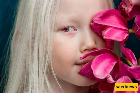 Meet the Incredible Baby Girl with Ever-Changing Eyes, Known as the 'Snow-White Child of Zal'—A Stunningly Unique Beauty 😍