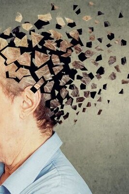 How To Prevent Alzheimer's?