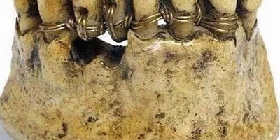 Strange and Fascinating Historical Facts You Won’t Find in History Books