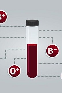 These Blood Types Are at Higher Risk of Stroke