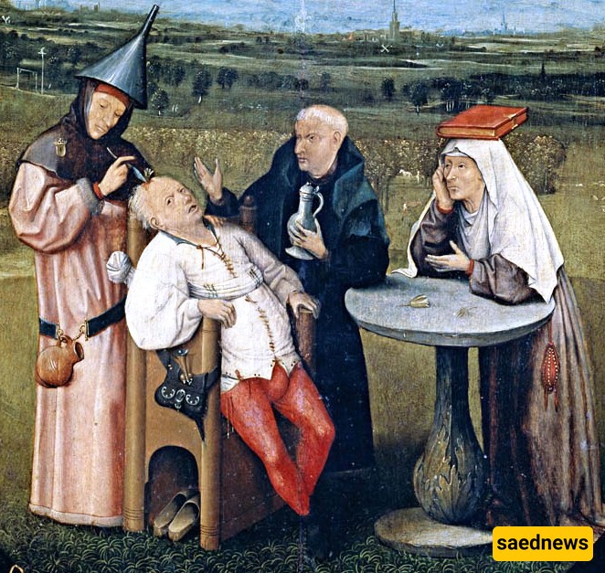 Trepanation