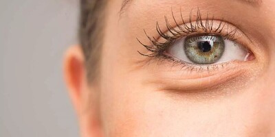 What Does Puffiness Around the Eyes Indicate?