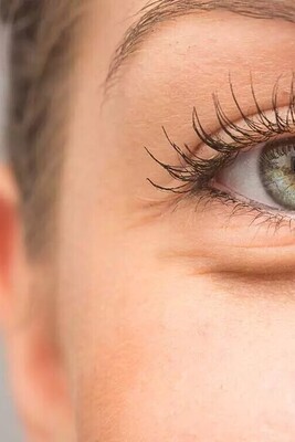 What Does Puffiness Around the Eyes Indicate?