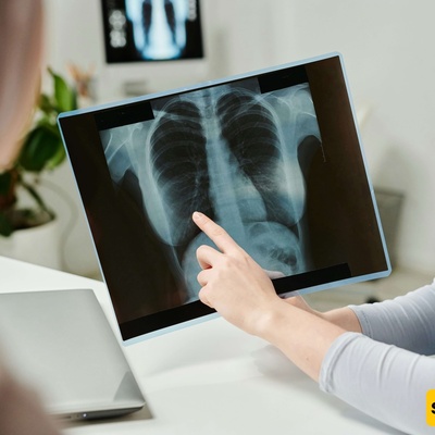 Radiology’s AI Revolution Is Changing the Job, Not Eliminating It