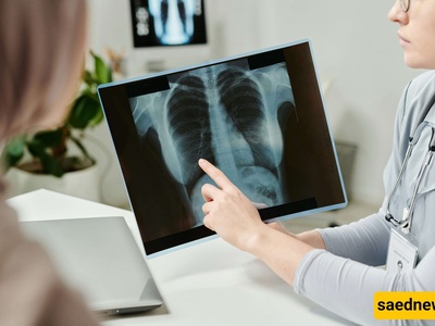 Radiology’s AI Revolution Is Changing the Job, Not Eliminating It