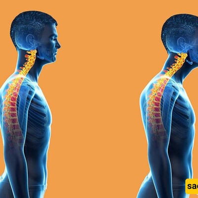 10 Corrective Exercises for Treating Lower Back Curvature and Its Causes