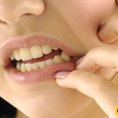 Uses and Side Effects of Dentol Drops