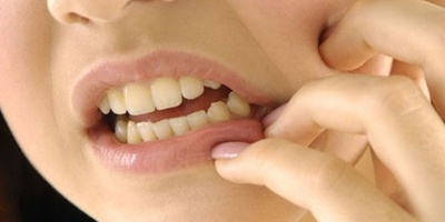 Uses and Side Effects of Dentol Drops