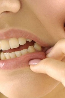 Uses and Side Effects of Dentol Drops