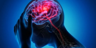 Early Signs of Stroke That Are Often Overlooked