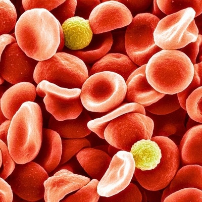 Mysterious Blood Type Doctors Had Been Searching for Years Finally Identified!