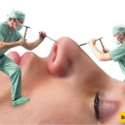 Girl Undergoes More Than 30 Cosmetic Surgeries for Her Fiancé