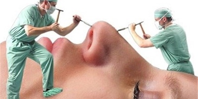 Girl Undergoes More Than 30 Cosmetic Surgeries for Her Fiancé