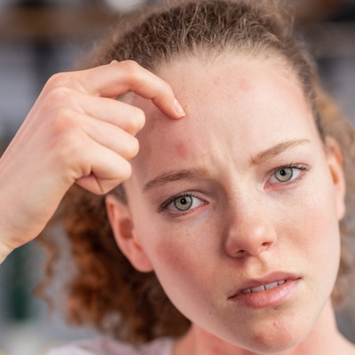 What Could Itchy Forehead Be A Sign Of?