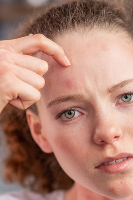 What Could Itchy Forehead Be A Sign Of?