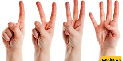 The Woman with 31 Fingers Who Is Called a Witch