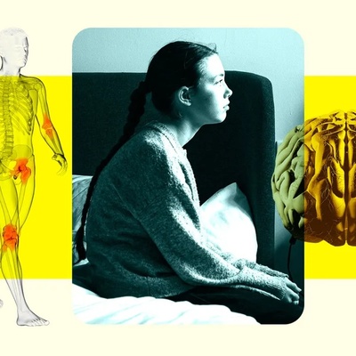 Arthritis Drug May Be the Key to Treating Resistant Depression