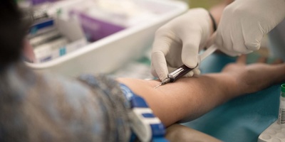 If You Feel Such Pain in the Joint, Get a Blood Test Immediately