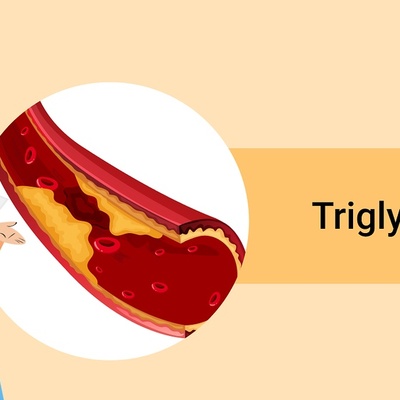 7 Tips to Lower Triglycerides Naturally