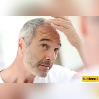 Should You Pluck a White Hair? Scholars Don’t Even Agree