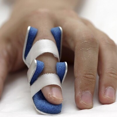 Exercise Movements and Necessary Actions After Treating Finger Fractures