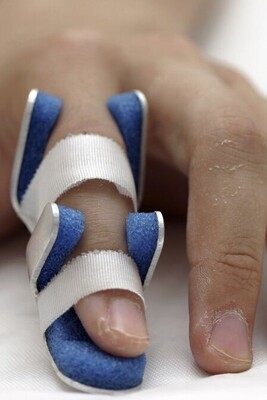Exercise Movements and Necessary Actions After Treating Finger Fractures