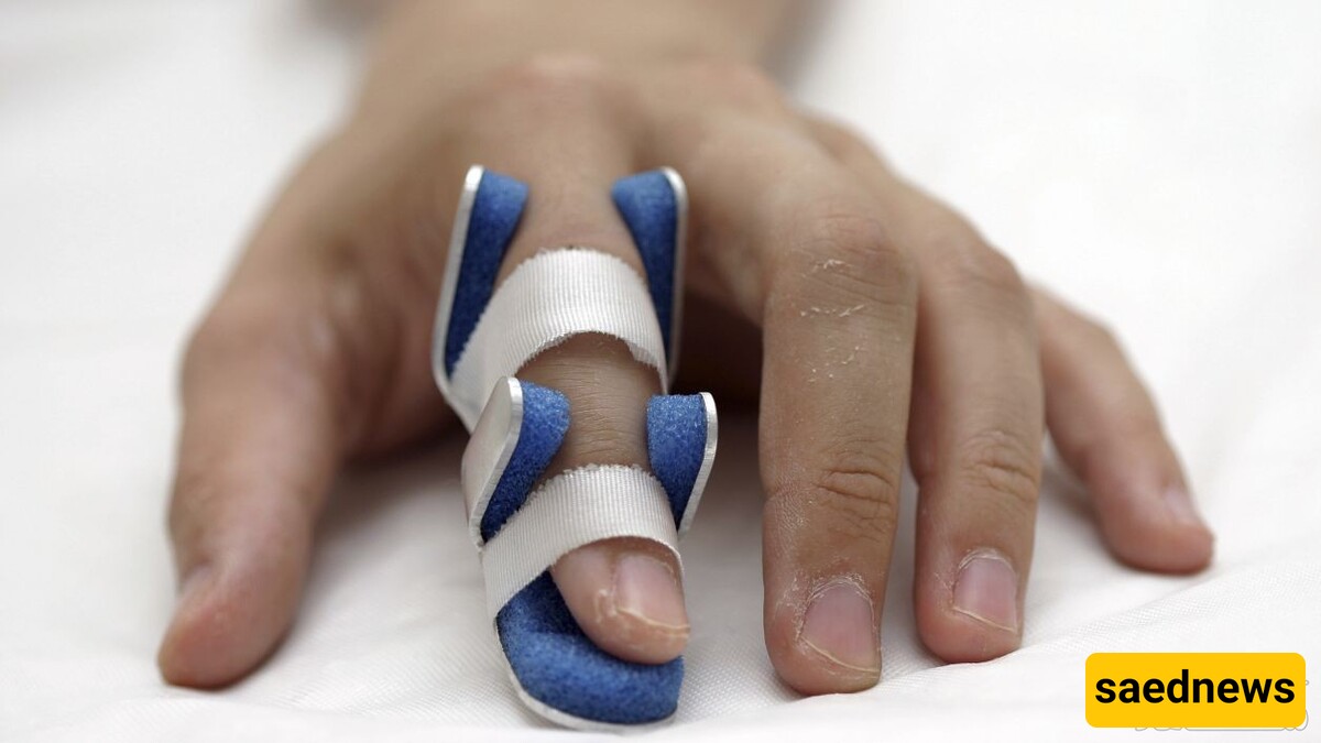 Exercise Movements and Necessary Actions After Treating Finger Fractures