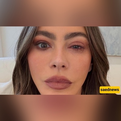“Oh no!” — Sofia Vergara Missed the Emmys After a Sudden, Dramatic Eye Allergy