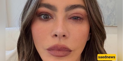 “Oh no!” — Sofia Vergara Missed the Emmys After a Sudden, Dramatic Eye Allergy
