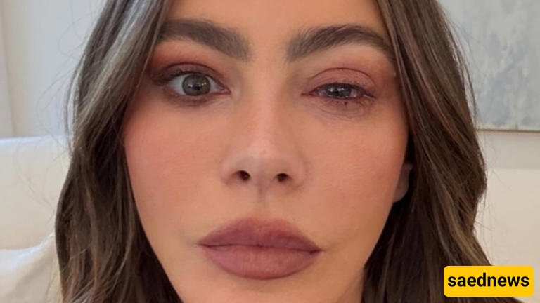 “Oh no!” — Sofia Vergara Missed the Emmys After a Sudden, Dramatic Eye Allergy