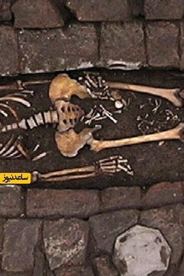 The Mysterious Case of a Fetus Born in a Grave