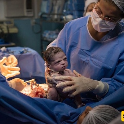 This Newborn’s Strange Expression at Birth Went Viral Worldwide!