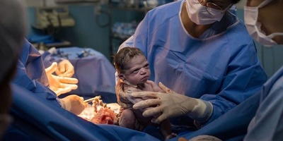 This Newborn’s Strange Expression at Birth Went Viral Worldwide!