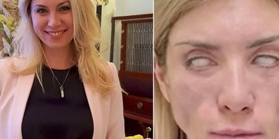 Russian Beauty Queen Suffers Devastating Consequences After Surgery