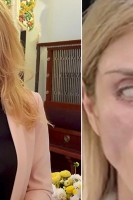 Russian Beauty Queen Suffers Devastating Consequences After Surgery