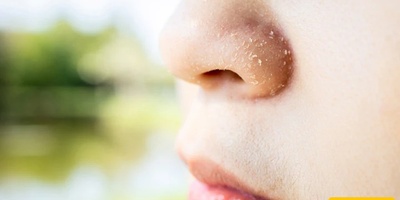 Why Does The Skin Around The Nose Dry Out Faster In Cold Weather?