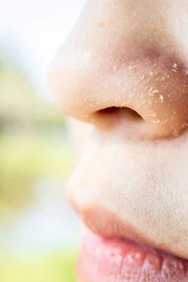 Why Does The Skin Around The Nose Dry Out Faster In Cold Weather?
