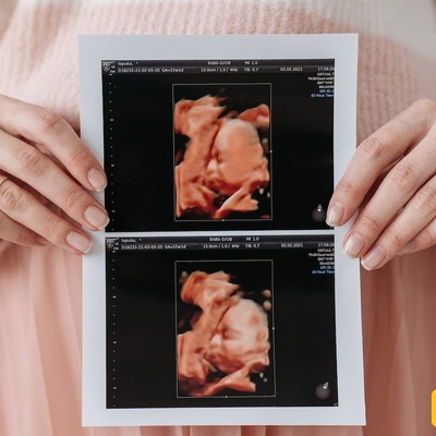 The Only Taste a Fetus Can Perceive in the Womb