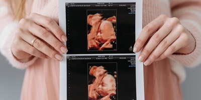 The Only Taste a Fetus Can Perceive in the Womb