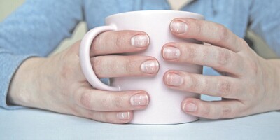 Causes of White Spots on Nails and How to Treat Them