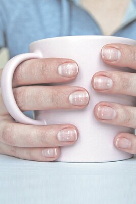 Causes of White Spots on Nails and How to Treat Them