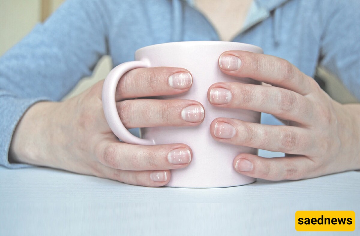 Causes of White Spots on Nails and How to Treat Them