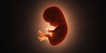 Miscarriage of a Young Woman During Phone Snatching in Tehranpars