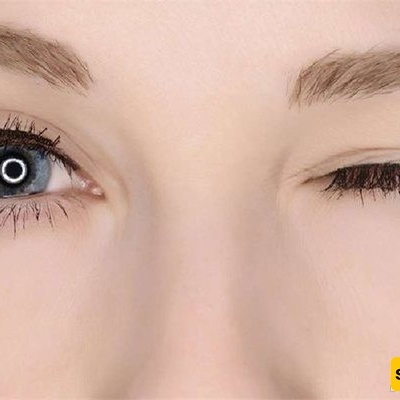 When Is Eyelid Twitching Dangerous?