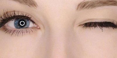 When Is Eyelid Twitching Dangerous?